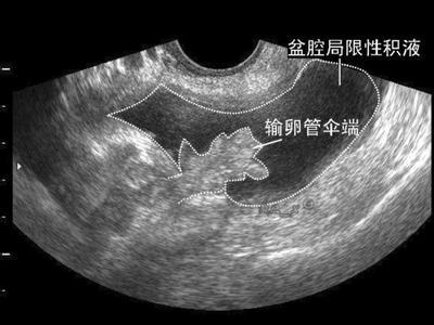 最新盆腔闭合手法教程，提升操作技能，掌握实战技巧